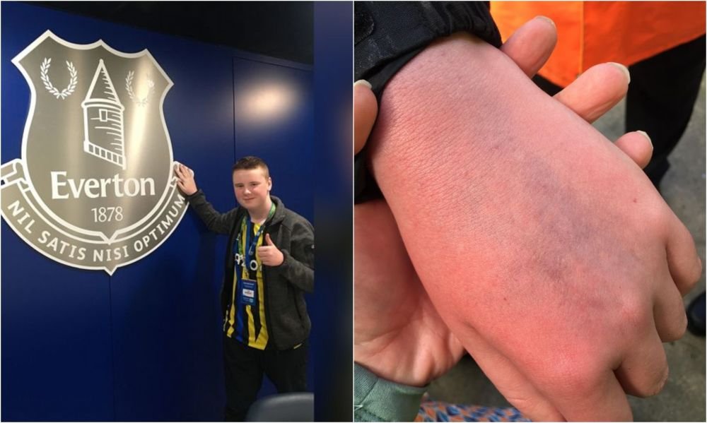 Fanul căruia Ronaldo i-a distrus telefonul suferă de autism! Dezvăluirile mamei: atacantul i-a &icirc;nvinețit m&acirc;na copilului