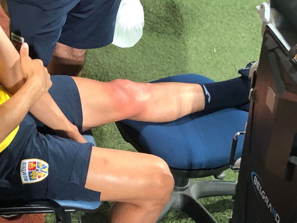 Lovitură de proporții primită de FCSB după debutul naționalei în Liga Națiunilor! A pierdut un jucător extrem de important_2