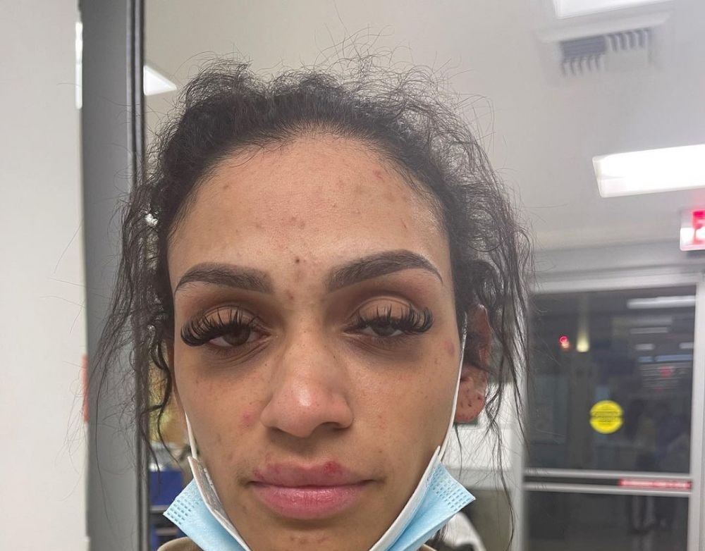 „M-a abuzat în toate modurile! Am fost strangulată până la leșin!” Dezvăluiri cutremurătoare făcute de soția unui sportiv _6