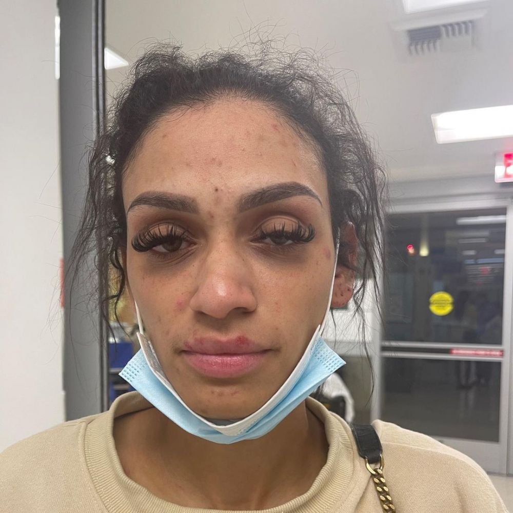Și-a mutilat soția după ce a agresat-o, iar acum riscă 11 ani și 8 luni de închisoare! Sportivul a pledat nevinovat_6