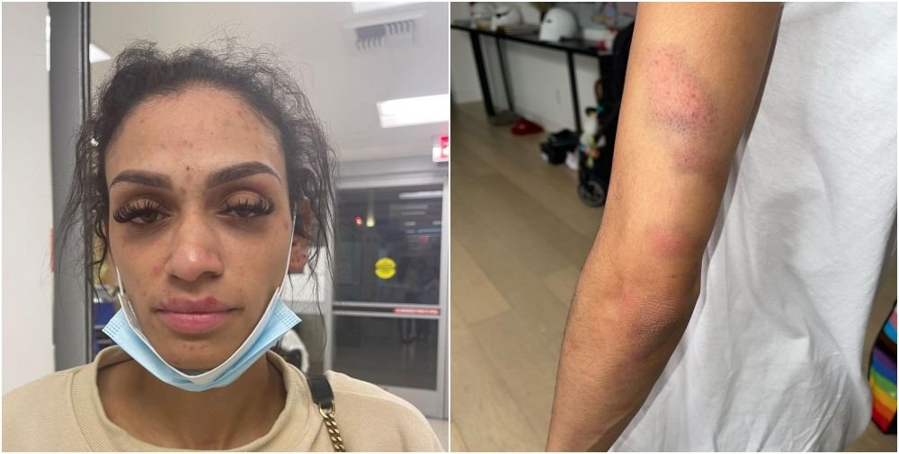 Și-a mutilat soția după ce a agresat-o, iar acum riscă 11 ani și 8 luni de închisoare! Sportivul a pledat nevinovat_9