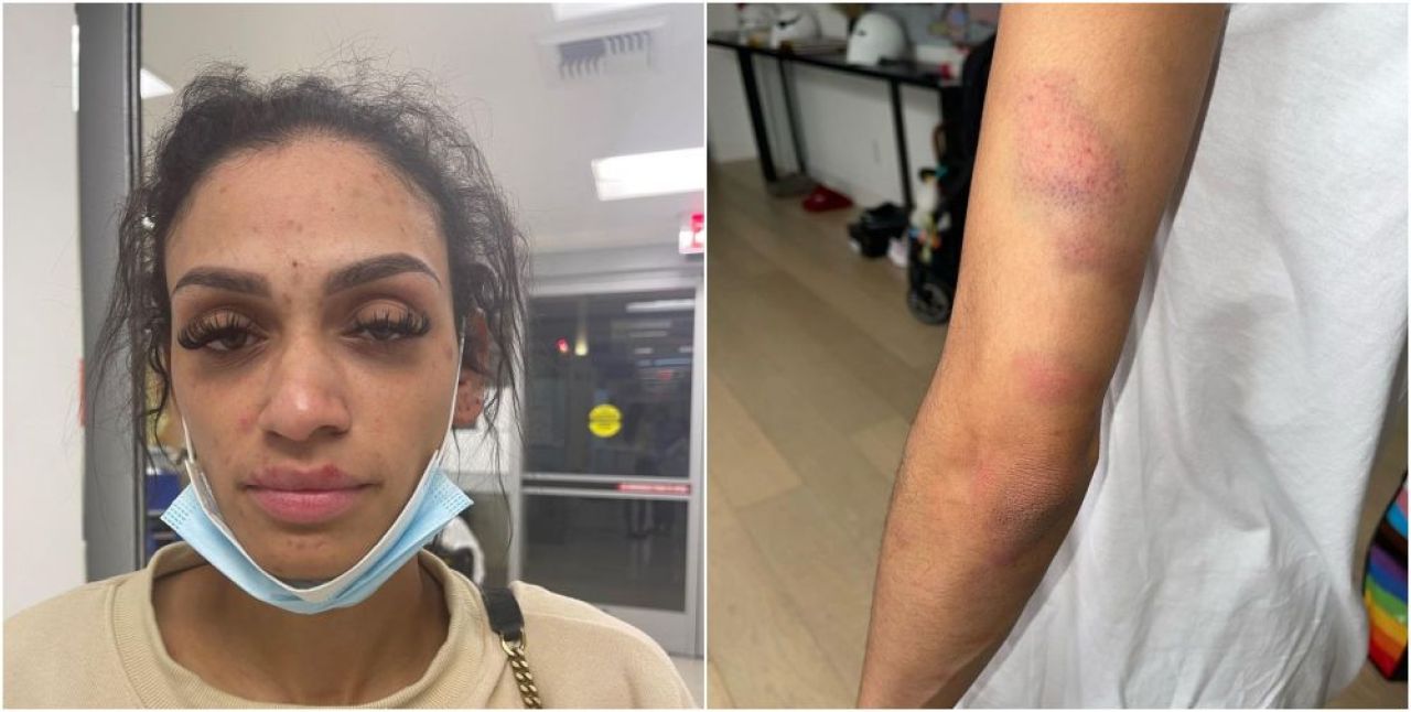 Și-a mutilat soția după ce a agresat-o, iar acum riscă 11 ani și 8 luni de închisoare! Sportivul a pledat nevinovat_9