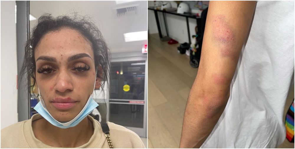Și-a mutilat soția după ce a agresat-o, iar acum riscă 11 ani și 8 luni de închisoare! Sportivul a pledat nevinovat_9