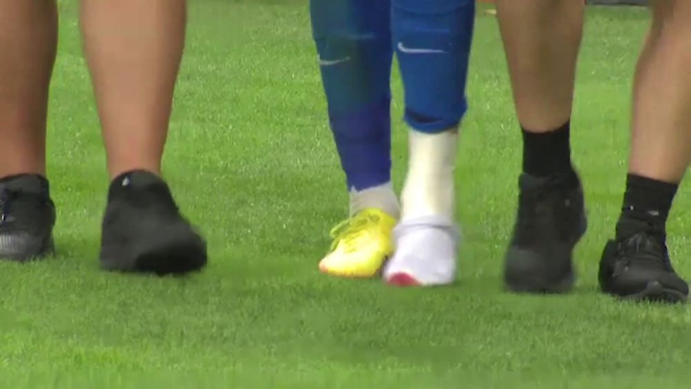 Accidentare cu s&acirc;nge pentru David Miculescu. Cum arată piciorul fotbalistului&nbsp;