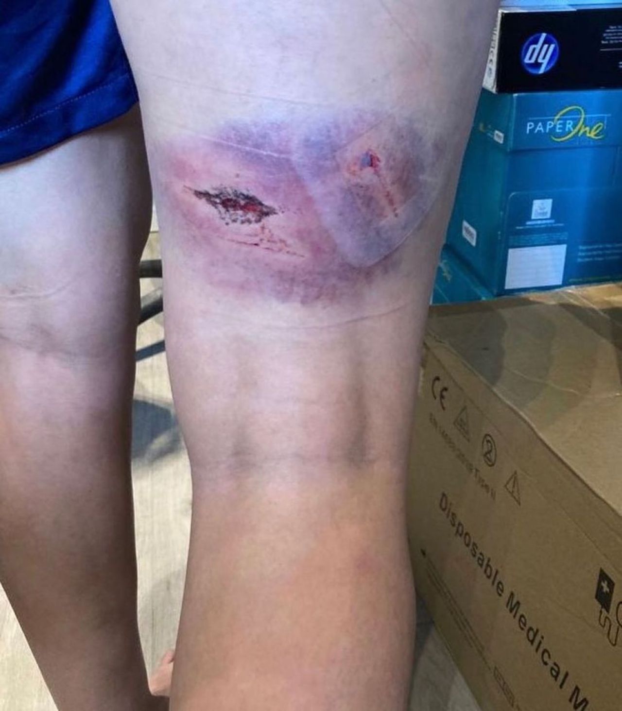 A fost snopită în bătaie de doi bărbați, la ordinul unei colege, iar acum a rupt tăcerea: „Au vrut să-mi ia viața!” Imagini cutremurătoare _5