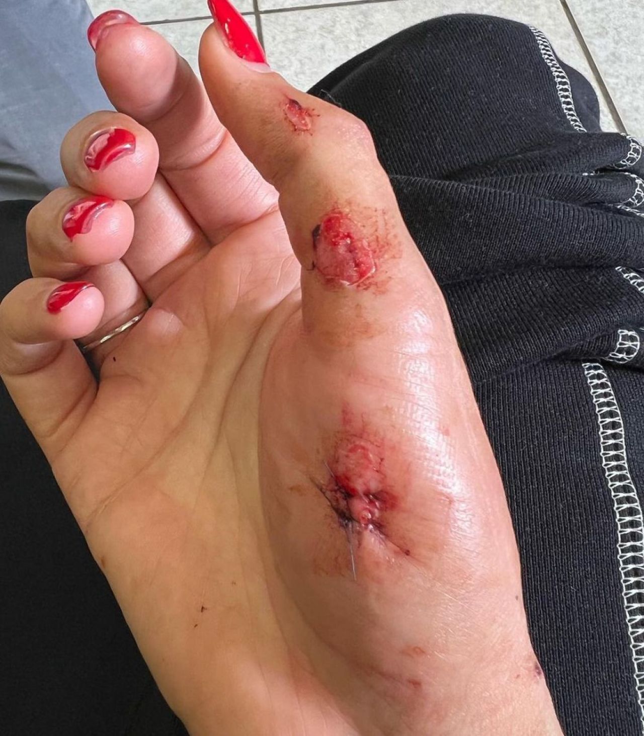 A fost snopită în bătaie de doi bărbați, la ordinul unei colege, iar acum a rupt tăcerea: „Au vrut să-mi ia viața!” Imagini cutremurătoare _7