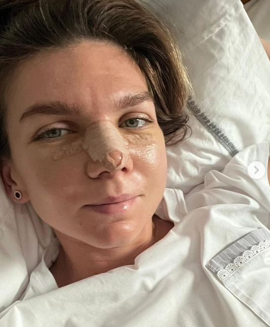 Simona Halep zâmbește! Prima fotografie cu tenismena din România după ce și-a dat jos bandajul în urma intervenției suferite _2