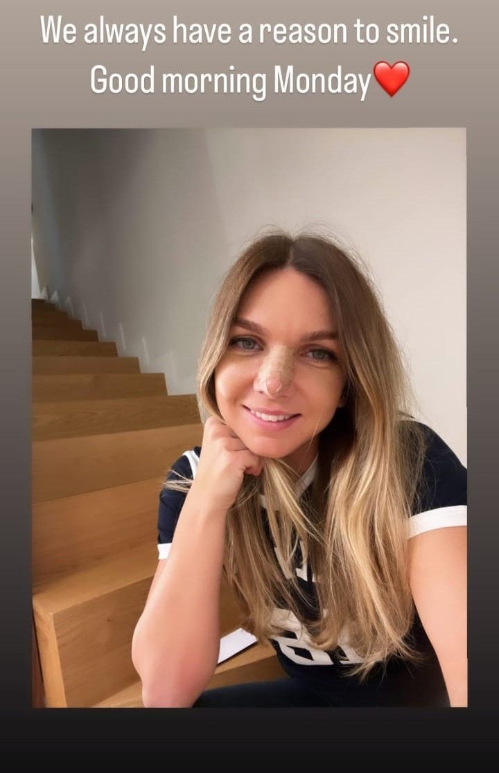 Simona Halep zâmbește! Prima fotografie cu tenismena din România după ce și-a dat jos bandajul în urma intervenției suferite _25