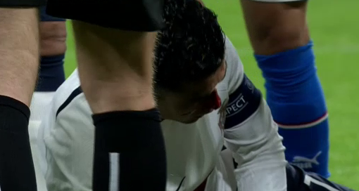 Cristiano Ronaldo, umplut de sânge în meciul Cehia - Portugalia!_4