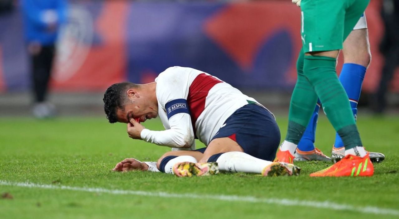 Imagini dure cu Cristiano Ronaldo! Fața i s-a umplut de sânge după o ciocnire cu portarul advers _4