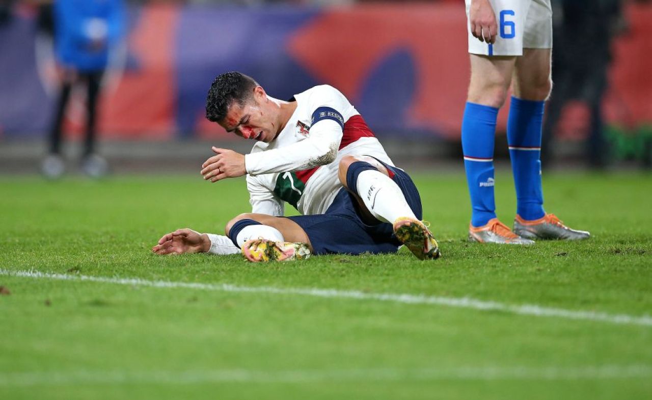 Imagini dure cu Cristiano Ronaldo! Fața i s-a umplut de sânge după o ciocnire cu portarul advers _5