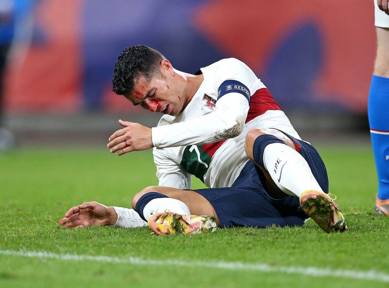 Imagini dure cu Cristiano Ronaldo! Fața i s-a umplut de sânge după o ciocnire cu portarul advers _8