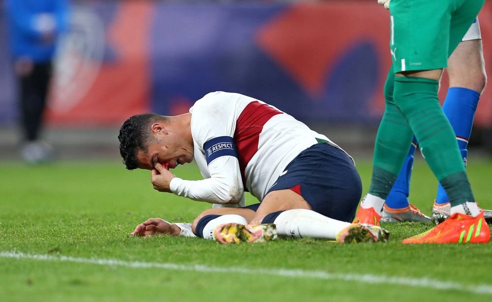 Imagini dure cu Cristiano Ronaldo! Fața i s-a umplut de sânge după o ciocnire cu portarul advers _9