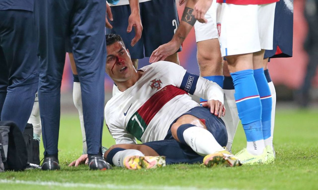 Imagini dure cu Cristiano Ronaldo! Fața i s-a umplut de sânge după o ciocnire cu portarul advers _10