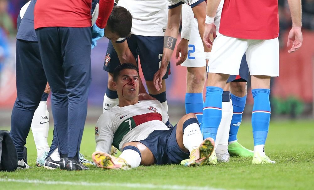 Imagini dure cu Cristiano Ronaldo! Fața i s-a umplut de sânge după o ciocnire cu portarul advers _11