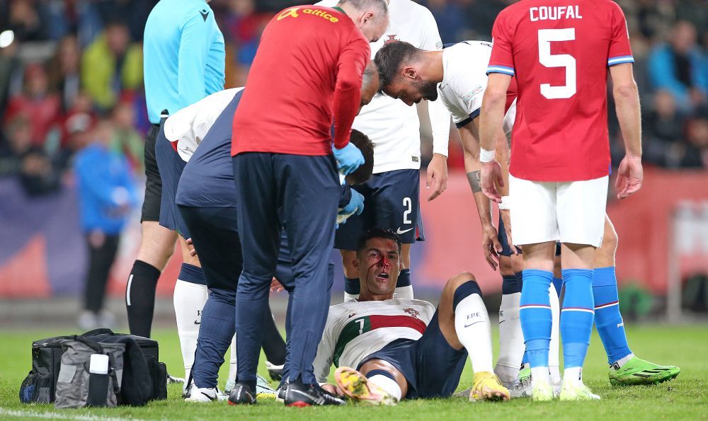 Imagini dure cu Cristiano Ronaldo! Fața i s-a umplut de sânge după o ciocnire cu portarul advers _12