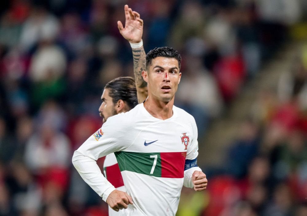 Imagini dure cu Cristiano Ronaldo! Fața i s-a umplut de sânge după o ciocnire cu portarul advers _16