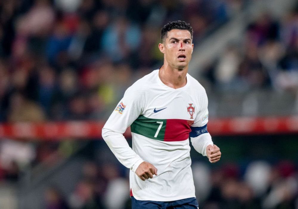 Imagini dure cu Cristiano Ronaldo! Fața i s-a umplut de sânge după o ciocnire cu portarul advers _17