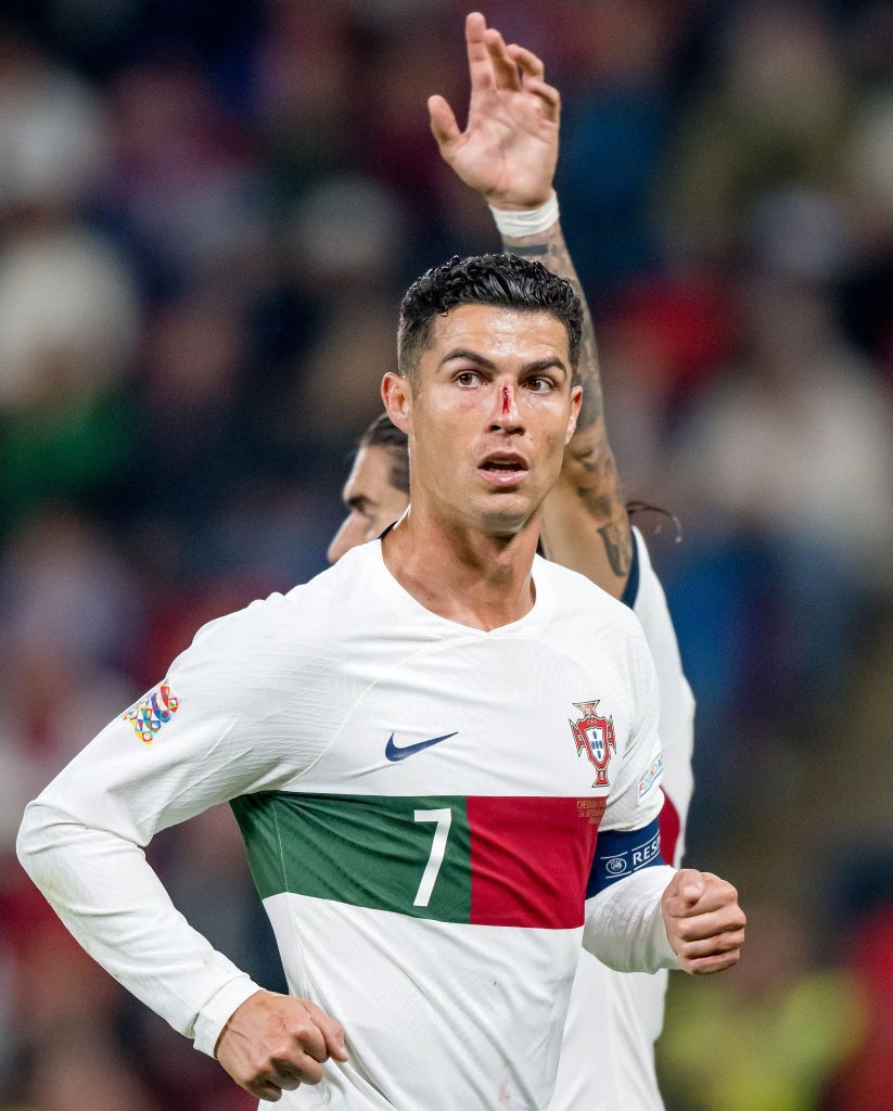 Imagini dure cu Cristiano Ronaldo! Fața i s-a umplut de sânge după o ciocnire cu portarul advers _18