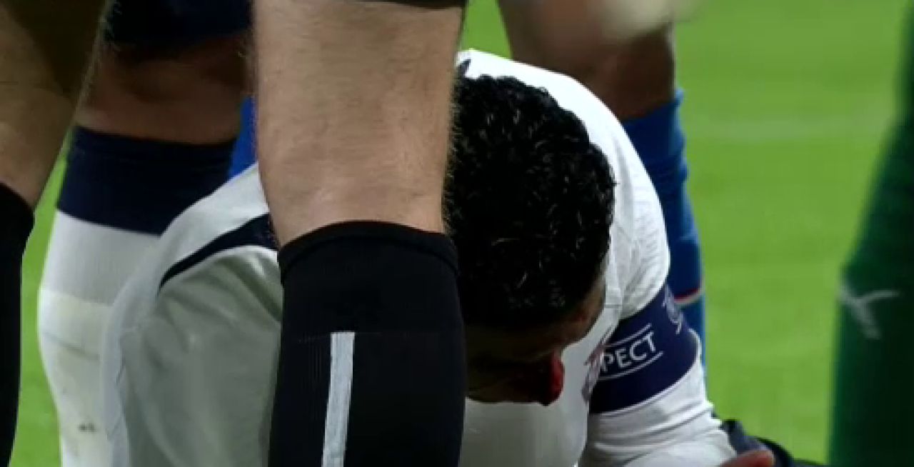 Accidentarea care l-a umplut de sânge a lăsat urme pe fața lui Cristiano Ronaldo! Cum a apărut azi portughezul _10