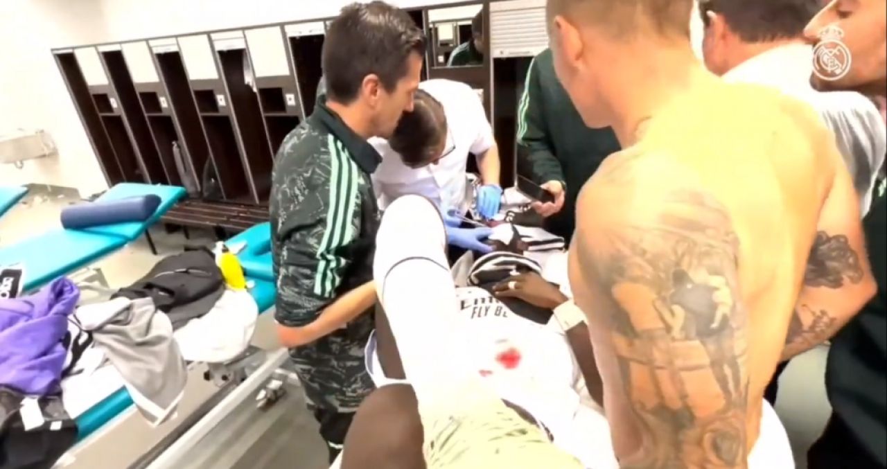 Au apărut imaginile cu Antonio Rudiger, cusut pe viu după accidentarea horror suferită! Doi jucători de la Real au stat alături de el _1