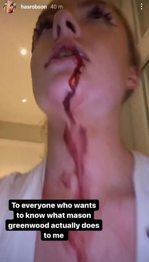 Mason Greenwood a fost arestat! Ce au transmis autoritățile și cu ce a fost pus sub acuzare_3