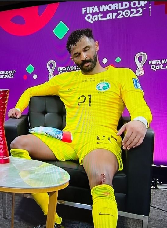 Imagini incredibile! Al Owais, portarul Arabiei Saudite, a avut nevoie de copci după ce și-a făcut KO un coechipier