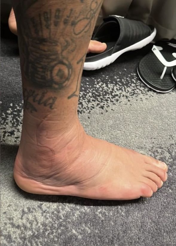 Răsturnare de situație în cazul lui Neymar! Când ar putea reveni + imaginile postate de brazilian_3