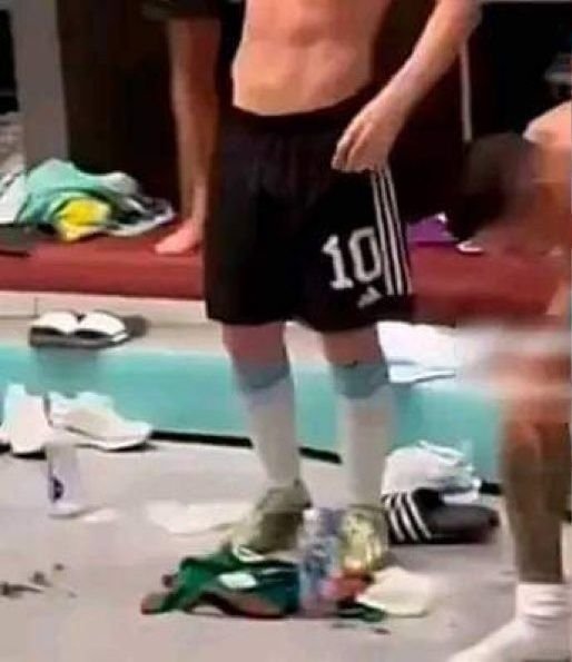 După ce l-a amenințat pe Messi, Canelo Alvarez l-a jignit și pe Aguero. Fanii se tem că suferă de o boală specifică boxerilor_8