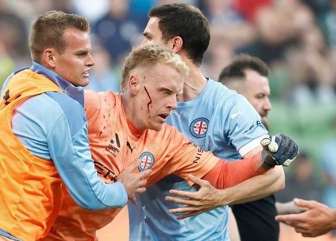 Derby-ul campionatului, cu jucători de la Mondial, abandonat după ce fanii au invadat terenul și unul dintre fotbaliști a fost rănit!&nbsp;