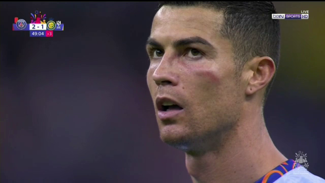 Cristiano Ronaldo, primele goluri în Arabia Saudită, după ce a fost învinețit de Keylor Navas: 