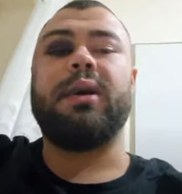 Imagini șocante! A acceptat să fie desfigurat pentru 5.000 de euro într-un concurs de dat palme! Cum arată după competiție  _10