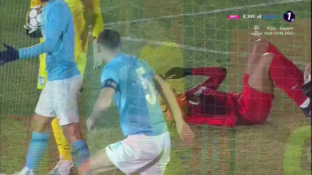 Imagini incredibile! Cum arată fața lui Igor Armaș după piciorul în cap primit de la Edjouma_7