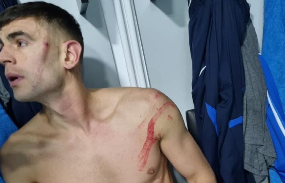 Cum arată acum Igor Armaș, după ce s-a ales cu răni vizibile după faultul dur al lui Edjouma_2