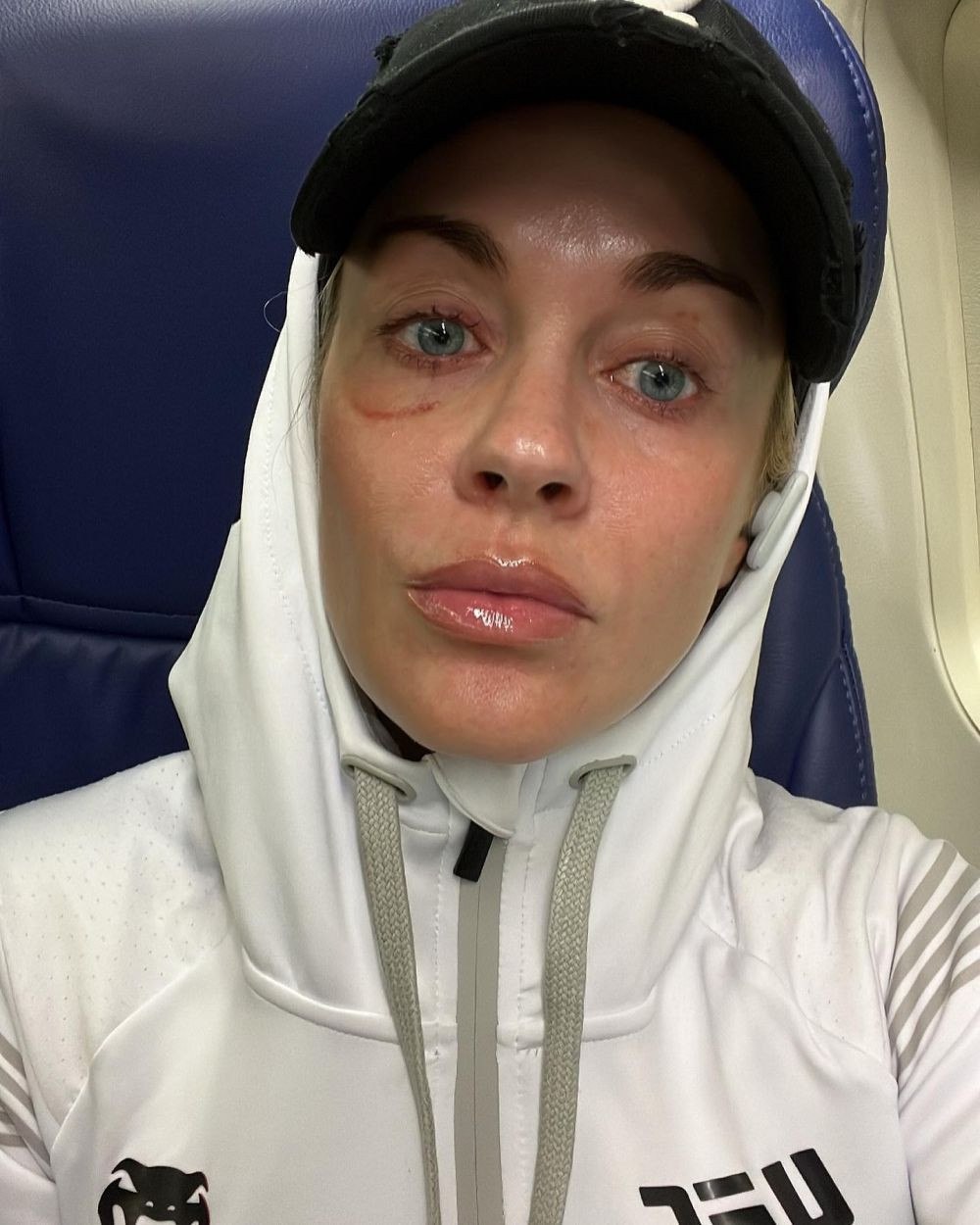 Laura Sanko, pasiune și dramă amoroasă în UFC_17