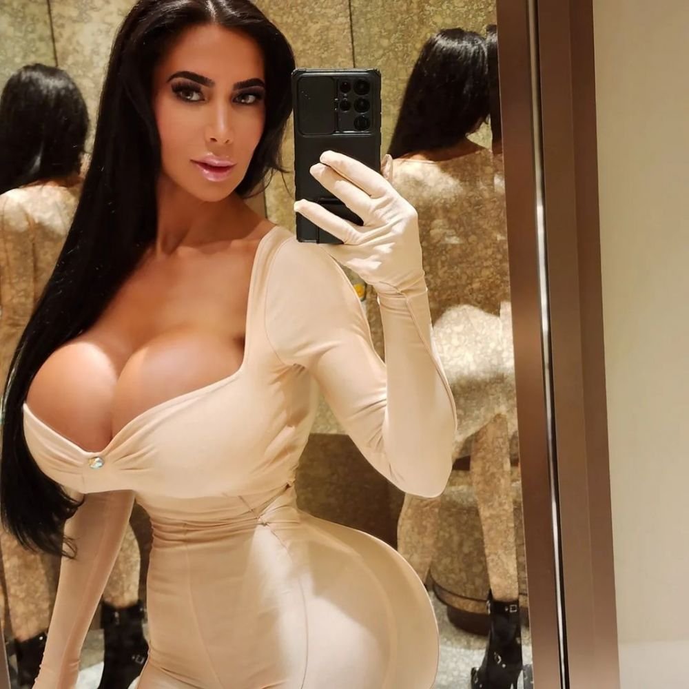 A murit după o operație ilegală făcută într-un hotel! Cauza morții tinerei care a plătit 40.000 de dolari pentru a arăta precum Kim Kardashian_4