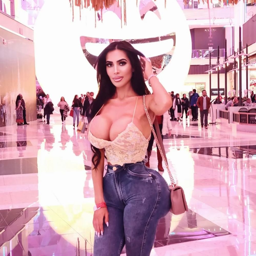 A murit după o operație ilegală făcută într-un hotel! Cauza morții tinerei care a plătit 40.000 de dolari pentru a arăta precum Kim Kardashian_13