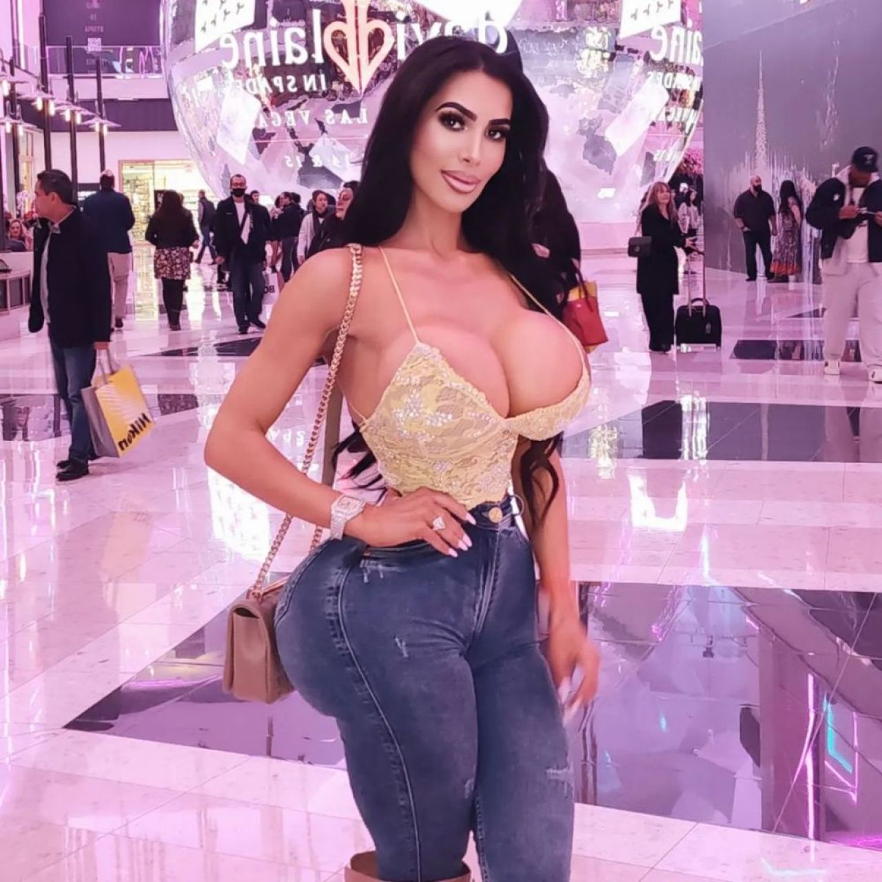 A murit după o operație ilegală făcută într-un hotel! Cauza morții tinerei care a plătit 40.000 de dolari pentru a arăta precum Kim Kardashian_14