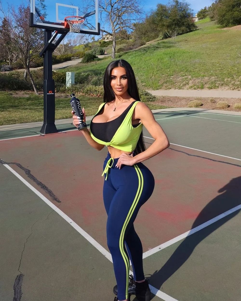 A murit după o operație ilegală făcută într-un hotel! Cauza morții tinerei care a plătit 40.000 de dolari pentru a arăta precum Kim Kardashian_24