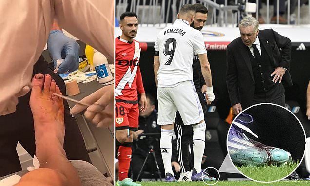 Karim Benzema, cusut pe viu imediat după meciul cu Rayo! A jucat aproape tot meciul cu o accidentare teribilă