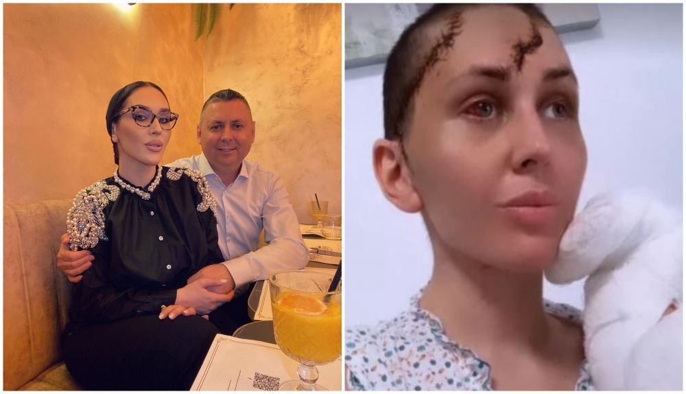 Declarații cutremurătoare ale femeii mutilate de soț cu ciocanul: „Îmi zicea: 'mai bine te văd moartă!' Am toate degetele rupte!”_20