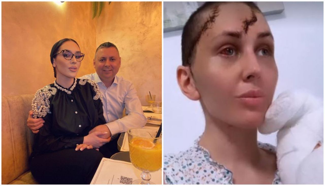 Declarații cutremurătoare ale femeii mutilate de soț cu ciocanul: „Îmi zicea: 'mai bine te văd moartă!' Am toate degetele rupte!”_20