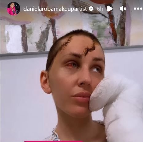 Declarații cutremurătoare ale femeii mutilate de soț cu ciocanul: „Îmi zicea: 'mai bine te văd moartă!' Am toate degetele rupte!”_24