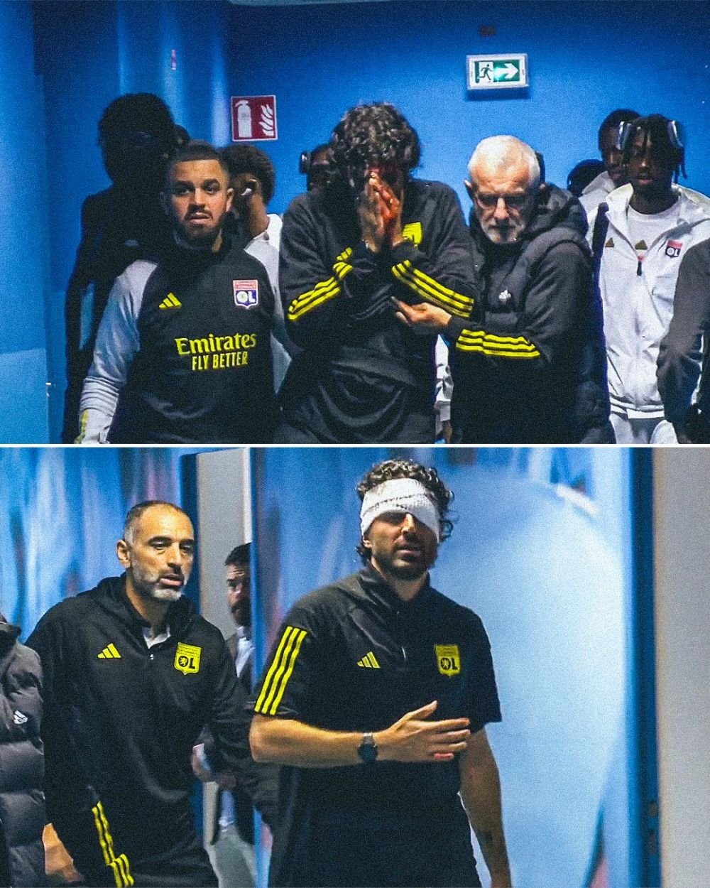 Cum arată Fabio Grosso, la o zi după ce a fost rănit grav de suporterii lui OM. Imagine impresionantă, în presa din Italia_7