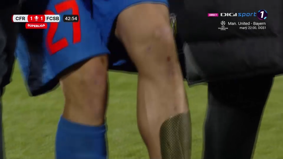 Pierdere importantă pentru FCSB! Darius Olaru a ieșit pe brațe, în finalul primei reprize cu CFR Cluj_14
