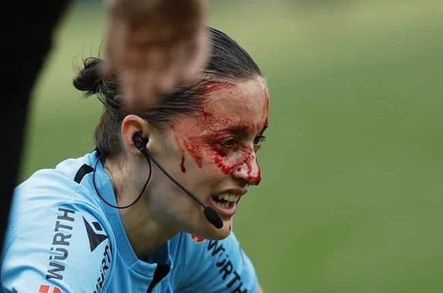Arbitră plină de s&acirc;nge &icirc;n La Liga! Guadalupe Porras, transportată la spital după ce s-a lovit de o cameră TV &icirc;n Betis Sevilla - Athletic Bilbao