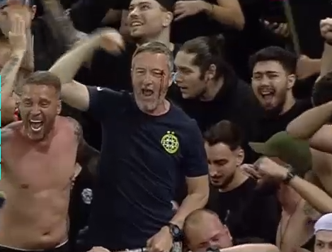 A comis-o! Mihai Stoica, plin de sânge la sărbătoarea de titlu a FCSB-ului! Un jucător al roș-albaștrilor i-a spart arcada_4