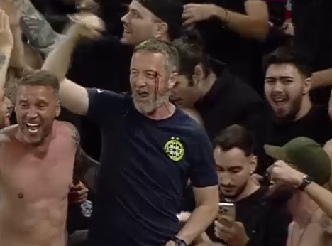 A comis-o! Mihai Stoica, plin de sânge la sărbătoarea de titlu a FCSB-ului! Un jucător al roș-albaștrilor i-a spart arcada_5