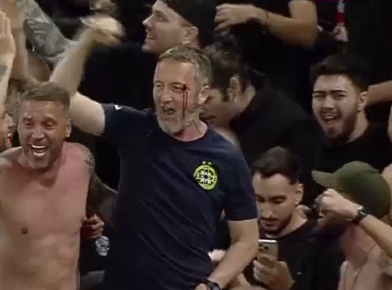 A comis-o! Mihai Stoica, plin de sânge la sărbătoarea de titlu a FCSB-ului! Un jucător al roș-albaștrilor i-a spart arcada_5