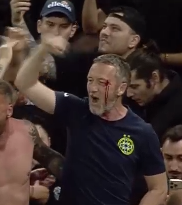 A comis-o! Mihai Stoica, plin de sânge la sărbătoarea de titlu a FCSB-ului! Un jucător al roș-albaștrilor i-a spart arcada_6